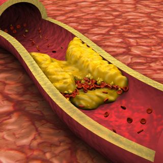 Riduce lo stress e l’infiammazione